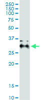 Anti-AIDA Polyclonal Antibody Pair