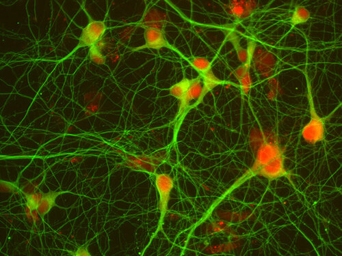 R-Hi - Rat Brain Hippocampus Neurons, Cryopreserved, in PNGM* BulletKit* =1 million cells/vial