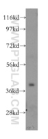 Anti-STBD1 Rabbit Polyclonal Antibody