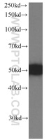 Anti-PSMD4 Mouse Monoclonal Antibody [clone: 3G1A1]