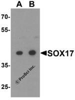 Anti-SOX17 Rabbit Polyclonal Antibody