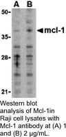 Anti-MCL1 Rabbit Polyclonal Antibody