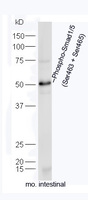 Anti-Smad1/5 Rabbit Polyclonal Antibody