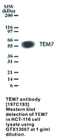 Anti-TEM7 Mouse Monoclonal Antibody [clone: 197C193]