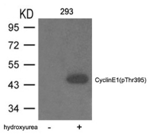 Cyclin E1 (phospho Thr395) Antibody