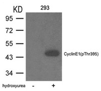 Anti-CCNE1 Rabbit Polyclonal Antibody