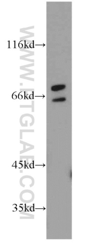 Anti-ST6GALNAC1