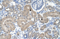 Anti-SSR1 Rabbit Polyclonal Antibody