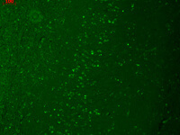Anti-TRPM7 Mouse Monoclonal Antibody [clone: S74-25]