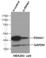 Anti-PDHA1 Mouse Monoclonal Antibody [clone: 2B3C10]