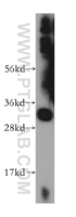 Anti-SLC25A45 Rabbit Polyclonal Antibody