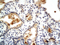 Anti-ESR1 Rabbit Polyclonal Antibody