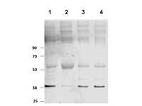 Anti-PKM Rabbit Polyclonal Antibody