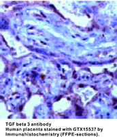 Anti-TGFB3 Rabbit Polyclonal Antibody