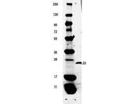Anti-EBI3 Rabbit Polyclonal Antibody (Biotin)