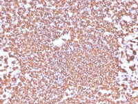 Anti-CD20 Rabbit Recombinant Antibody [clone: IGEL/4524R]