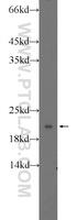 Anti-RPLP1 Rabbit Polyclonal Antibody