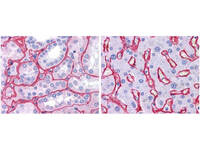 Anti-COL4A4 Rabbit Polyclonal Antibody (HRP)