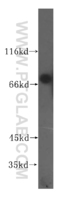 Anti-TGM4 Rabbit Polyclonal Antibody