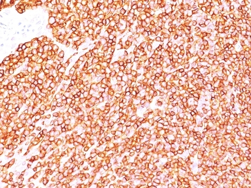 ANTIBODY ANTI-CD45 SPM570 100UG