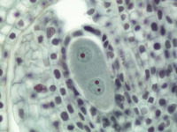 Lilium Ovary, Binucleate Embryo Sac Slide