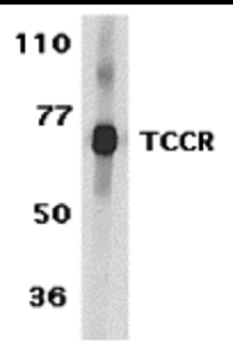 TCCR antibody