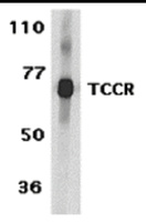 Anti-IL27RA Rabbit Polyclonal Antibody