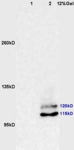 PI3 Kinase p110 beta(Ser1070) Antibody