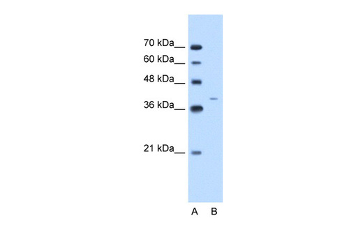 KRT13 antibody