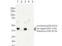 Anti-RRM2B Rabbit Polyclonal Antibody