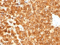 Anti-Melanoma gp100 Mouse Monoclonal Antibody [clone: PMEL/783]