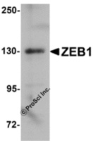 Anti-ZEB1 Rabbit Polyclonal Antibody