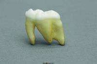 BoneClones® Replica Teeth