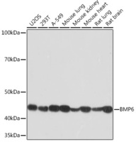Anti-BMP6 Rabbit Monoclonal Antibody [clone: ARC1025]