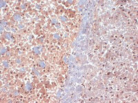 Anti-DLG1 Mouse Monoclonal Antibody [clone: S64-15]