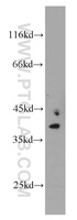 Anti-MRPS22 Rabbit Polyclonal Antibody