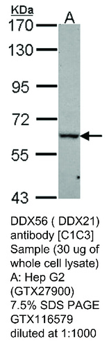 Rabbit Polyclonal antibody to DDX56 ( DDX21) (DEAD (Asp-Glu-Ala-Asp) box polypeptide 56)