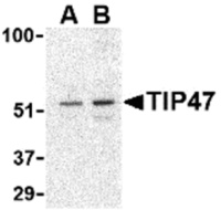 Anti-M6PRBP1 Rabbit Polyclonal Antibody