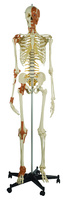Rudiger® Total Skeleton