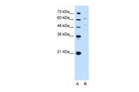 Anti-UGT1A4 Rabbit Polyclonal Antibody