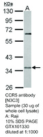 Anti-CCR5 Rabbit Polyclonal Antibody