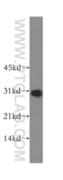 Anti-RPL7L1 Rabbit Polyclonal Antibody
