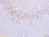 Anti-PLXB1 Rabbit Polyclonal Antibody