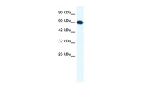 Anti-DDX6 Rabbit Polyclonal Antibody