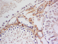 Anti-RPS6KA1 Rabbit Polyclonal Antibody