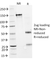 Anti-Interferon alpha 2 Mouse Monoclonal Antibody [clone: N27]