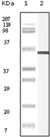 Anti-VIM Mouse Monoclonal Antibody [clone: 9E7E7 / 5G3F10]