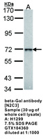 Anti-GLB1 Rabbit Polyclonal Antibody