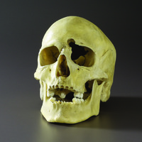 Plastic Skull with Gunshot Wound
