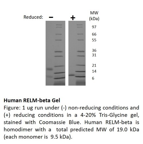 Human Recombinant RELM-beta (from <i>E. coli</i>)